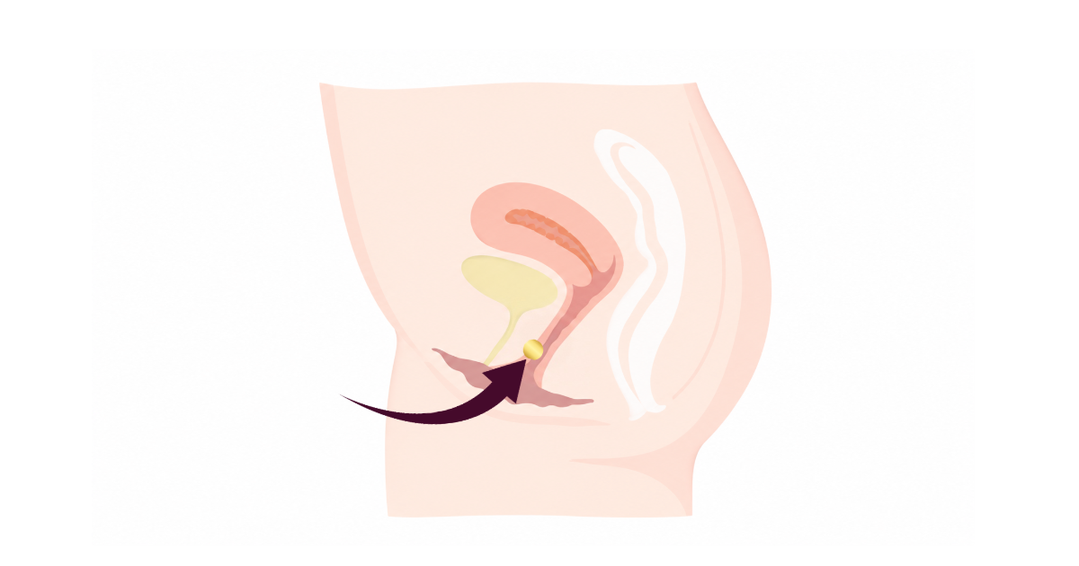 An illustrated diagram of the G-zone location inside the vagina. 
